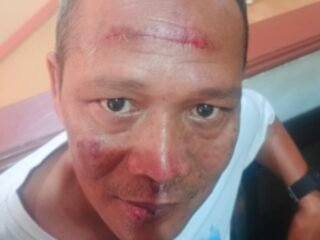 Sekretaris PWI Kota Tangsel Desak Polisi Usut Tuntas Dugaan Penganiayaan Pimred Banten.Net